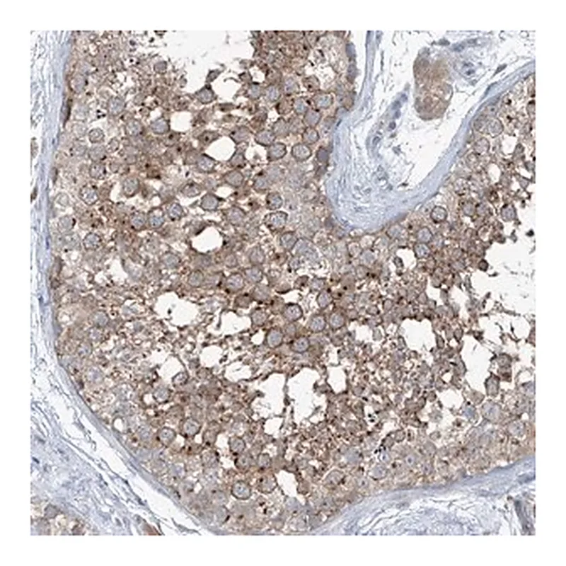 Merck Anti-SLC12A6 antibody produced in rabbit