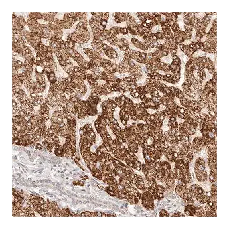 Merck Anti-IL1R2 antibody produced in rabbit
