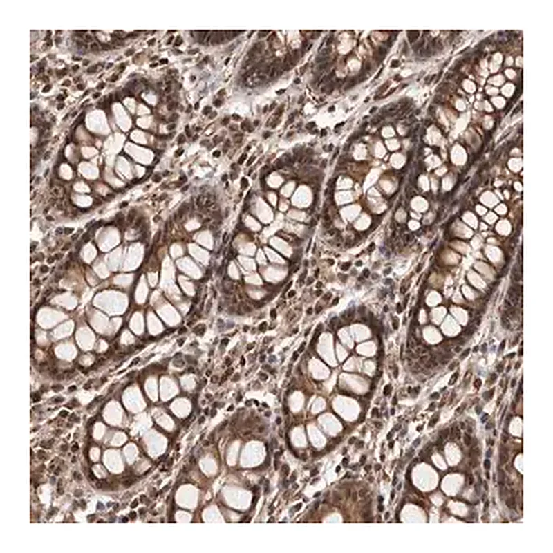 Merck Anti-ADAMTS20 antibody produced in rabbit