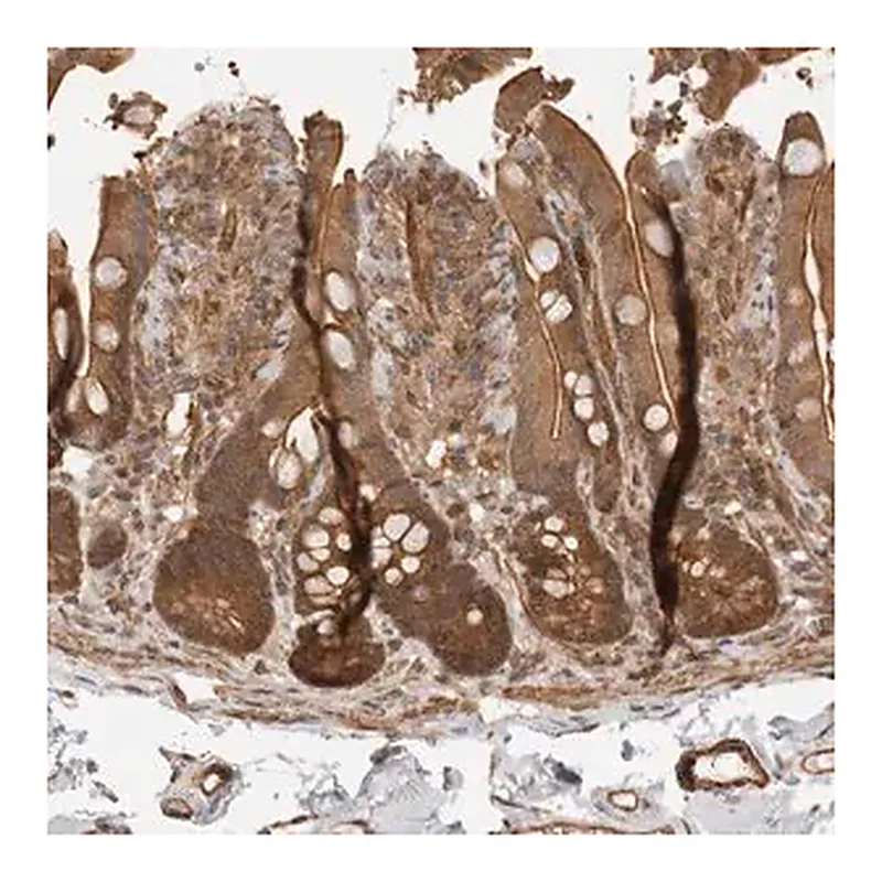 Merck Anti-ERN1 antibody produced in rabbit