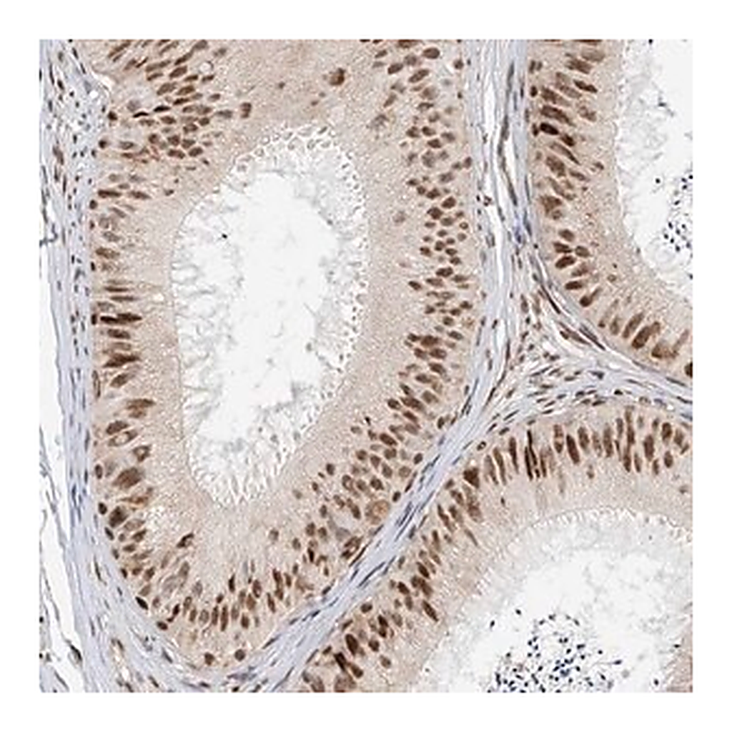 Merck Anti-ZNF514 antibody produced in rabbit