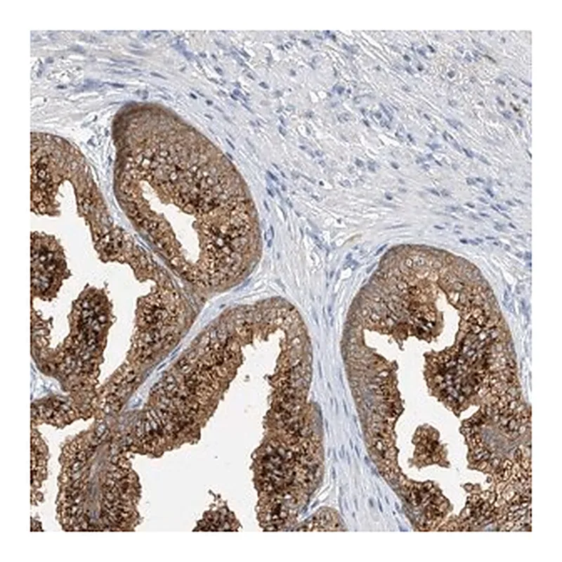 Merck Anti-POMGNT2 antibody produced in rabbit