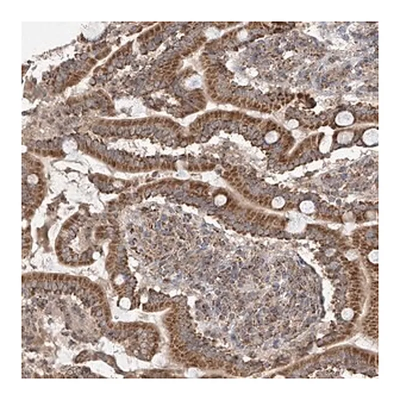 Merck Anti-UQCC1 antibody produced in rabbit