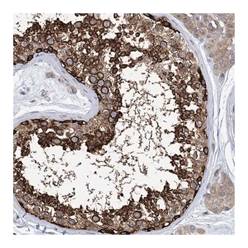 Merck Anti-DYNC1LI1 antibody produced in rabbit