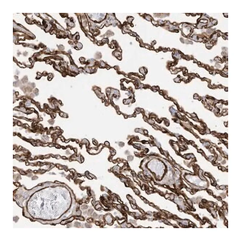 Merck Anti-ABCB7 antibody produced in rabbit