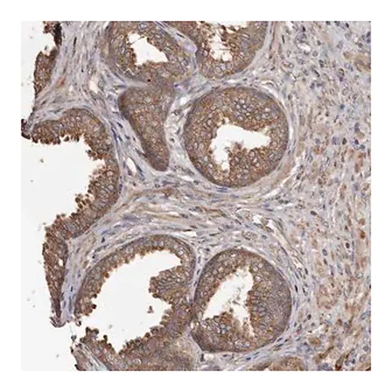 Merck Anti-STEAP2 antibody produced in rabbit