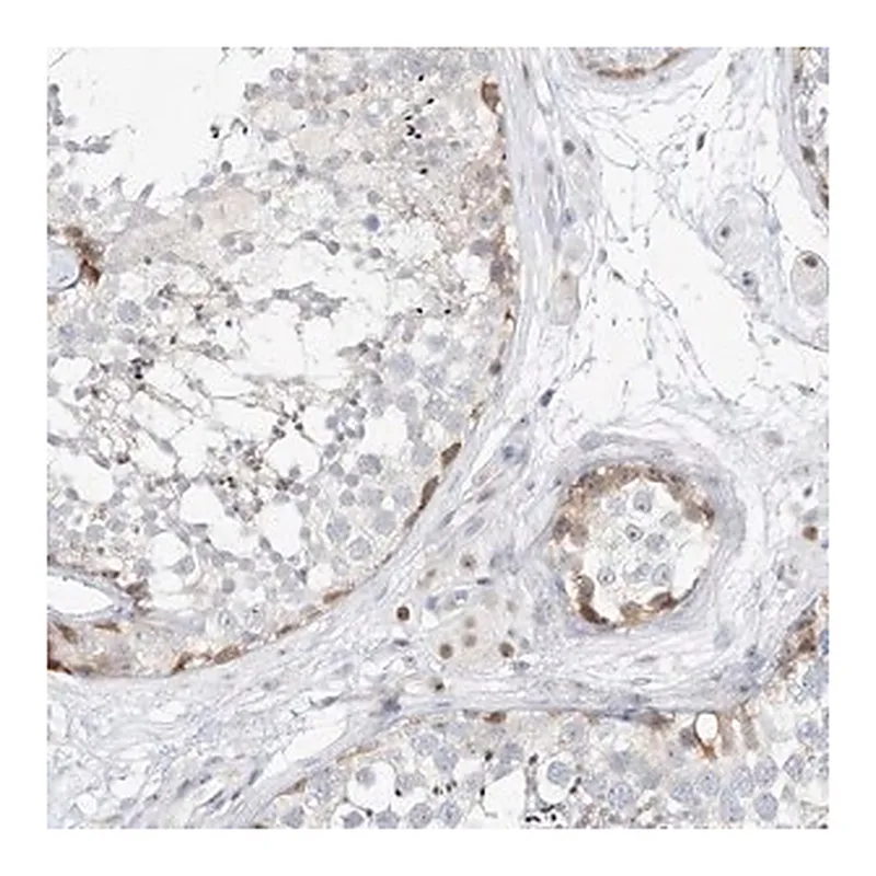 Merck Anti-SNU13 antibody produced in rabbit