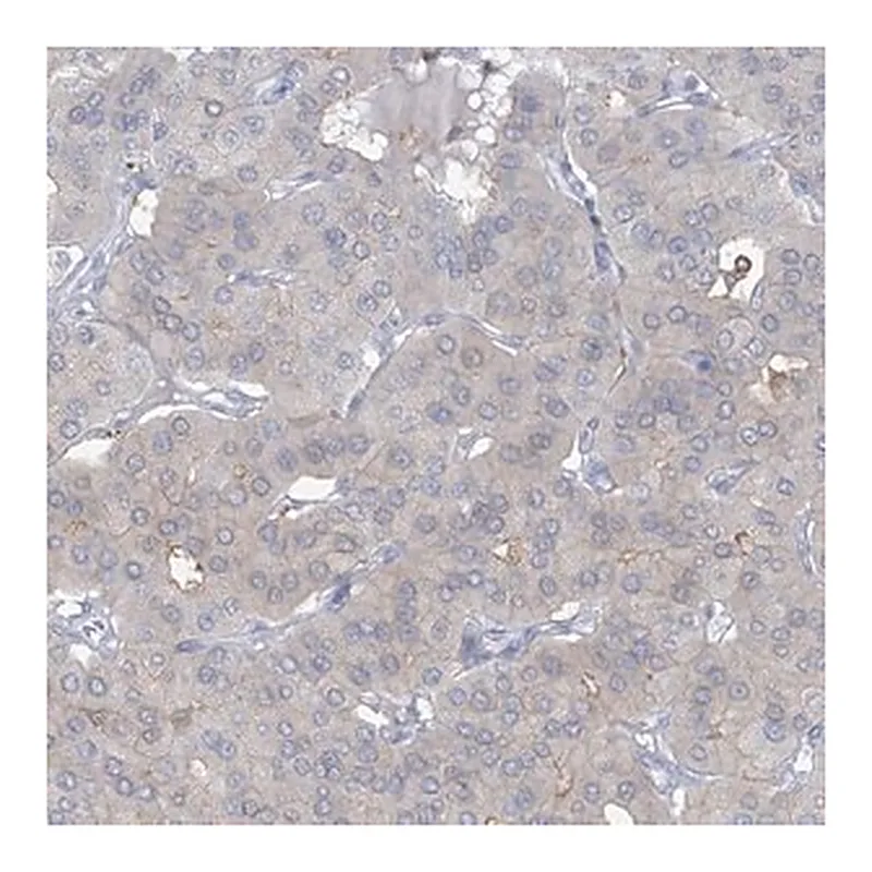 Merck Anti-TRMT2B antibody produced in rabbit