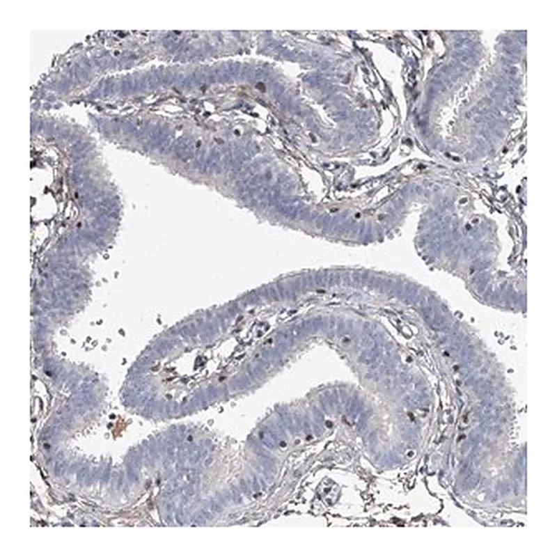 Merck Anti-HOXA3 antibody produced in rabbit