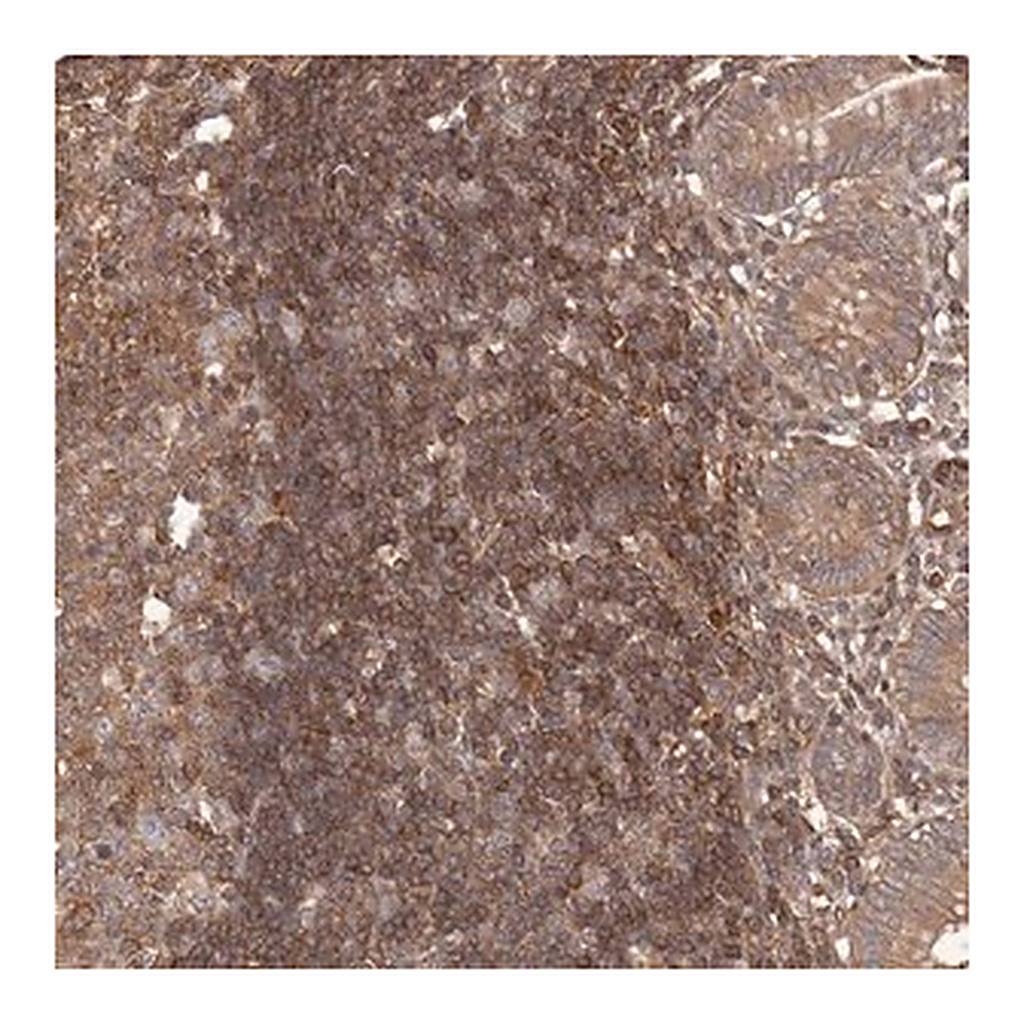 Merck Anti-NFKBIA antibody produced in rabbit