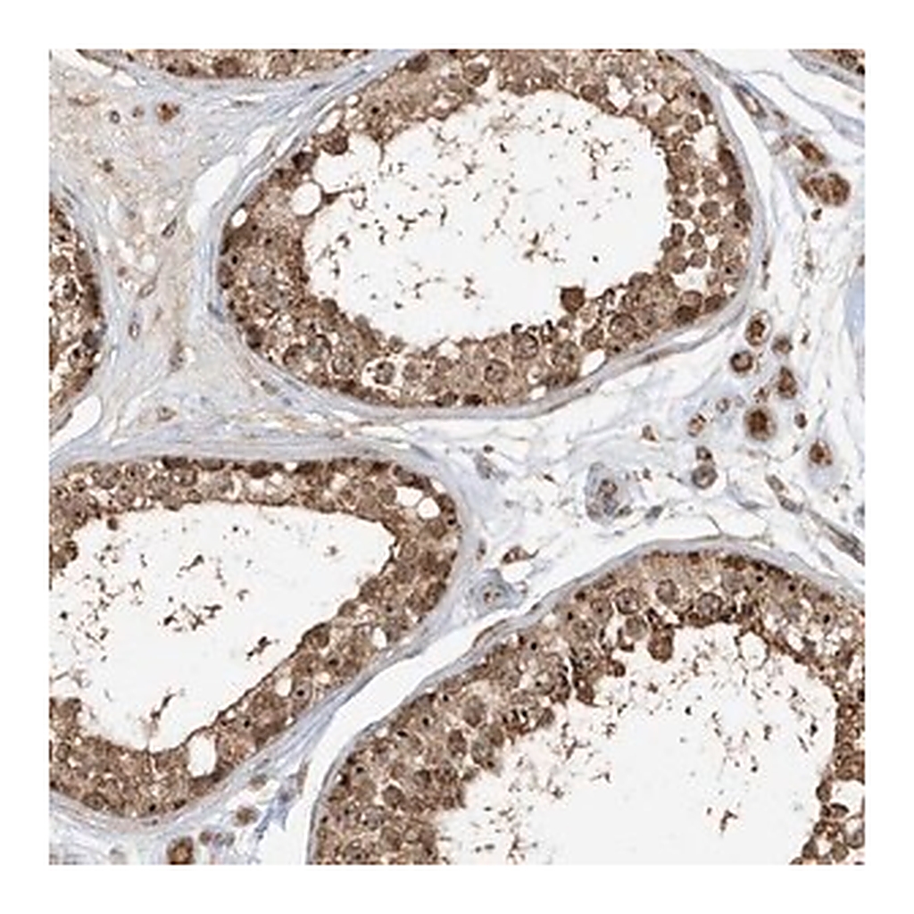 Merck Anti-ABCB9 antibody produced in rabbit