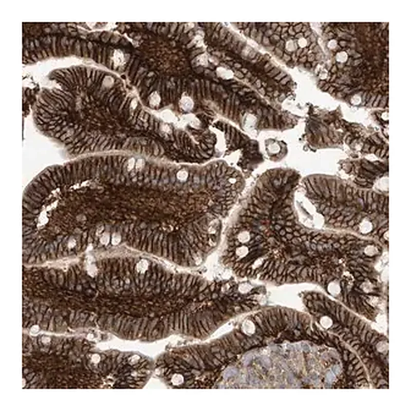 Merck Anti-FSD1L antibody produced in rabbit