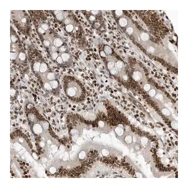 Merck Anti-ADI1 antibody produced in rabbit