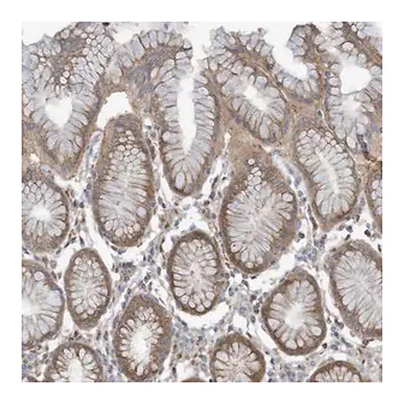 Merck Anti-ADAT2 antibody produced in rabbit