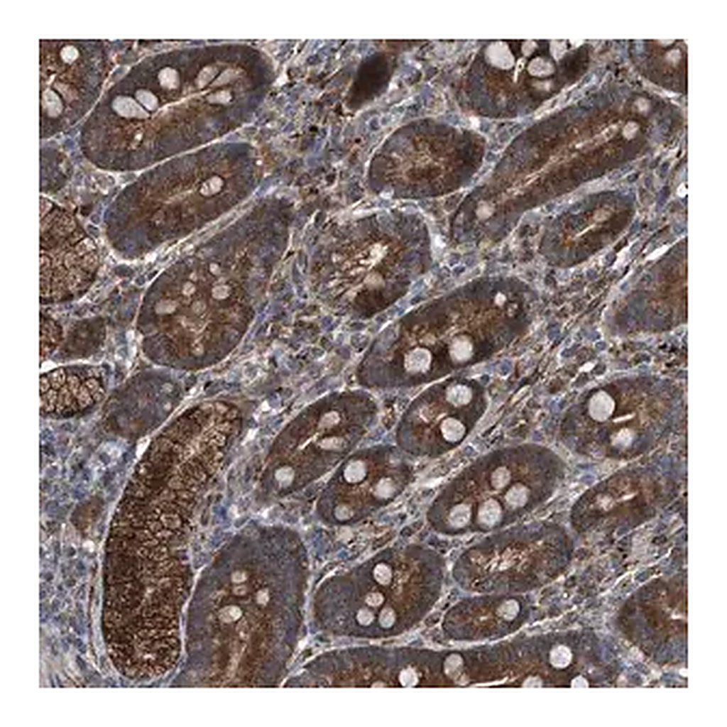 Merck Anti-SENP2 antibody produced in rabbit