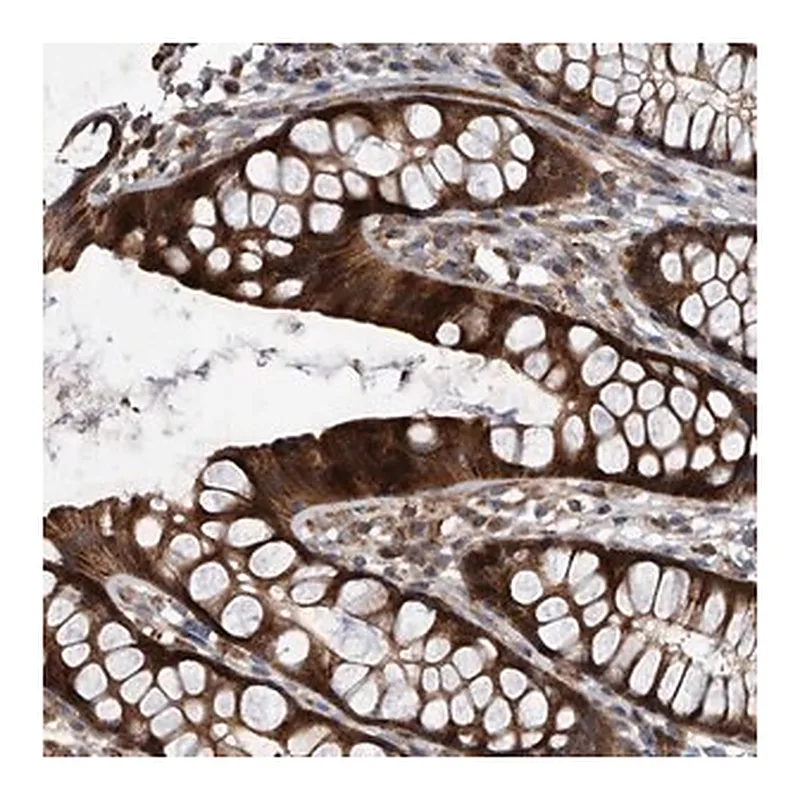 Merck Anti-USP47 antibody produced in rabbit