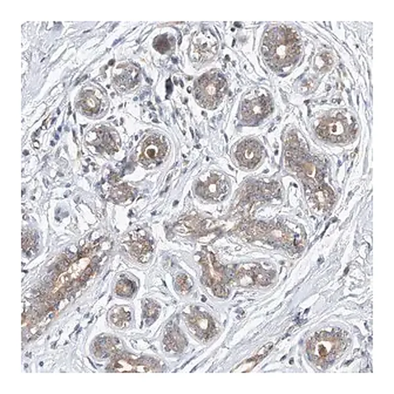 Merck Anti-DIRAS3 antibody produced in rabbit