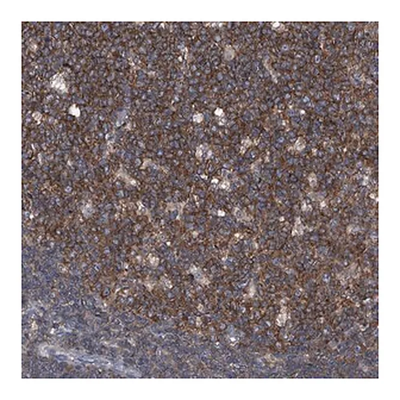 Merck Anti-PIP5K1A antibody produced in rabbit