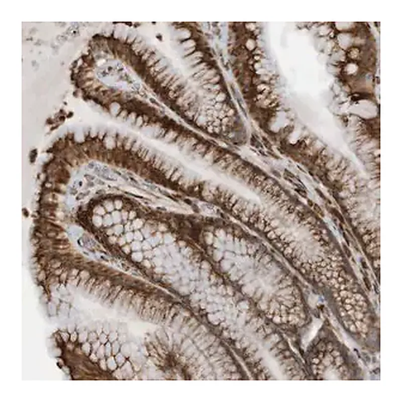 Merck Anti-ZBTB45 antibody produced in rabbit