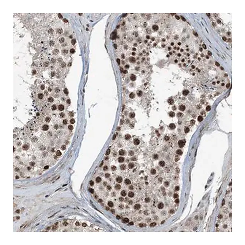 Merck Anti-TADA2B antibody produced in rabbit