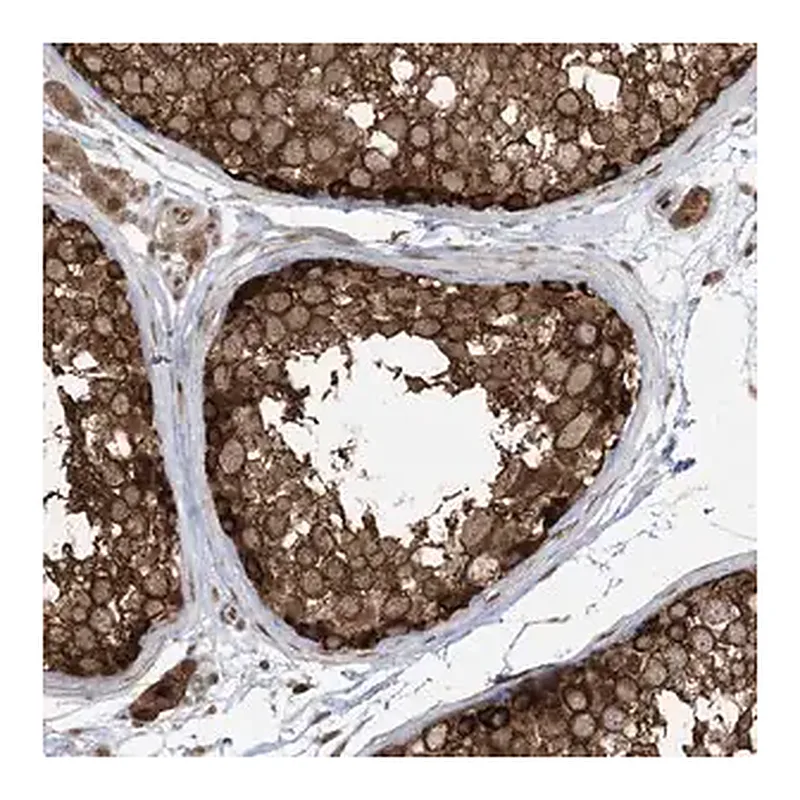 Merck Anti-ABCF3 antibody produced in rabbit