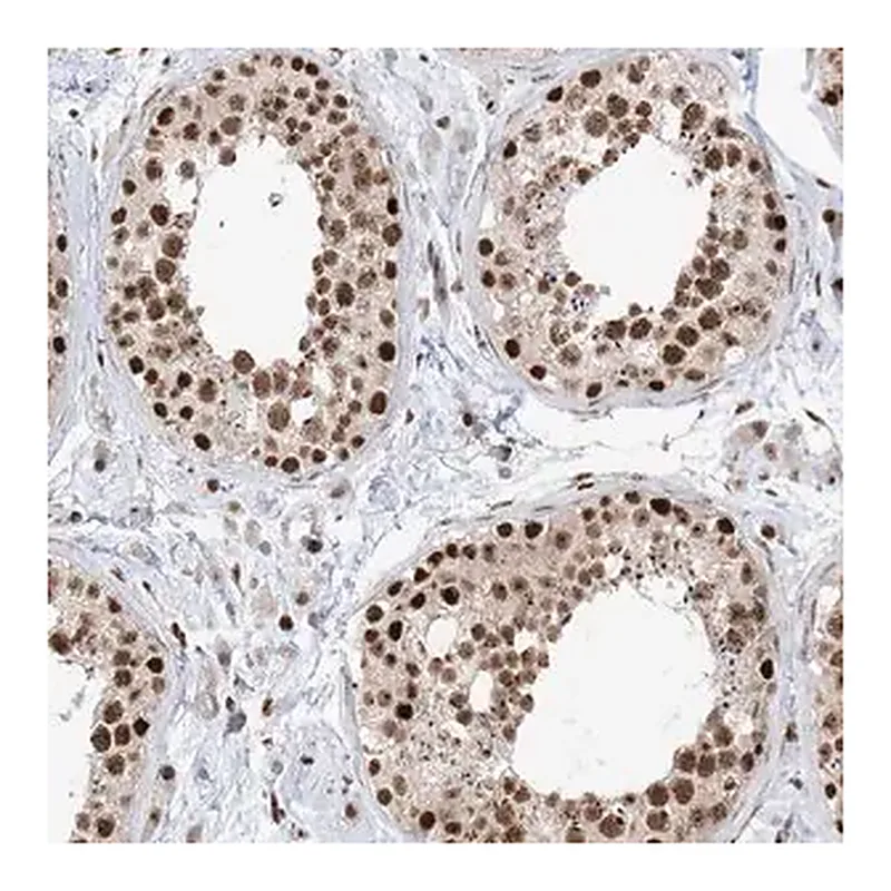 Merck Anti-SKIV2L2 antibody produced in rabbit