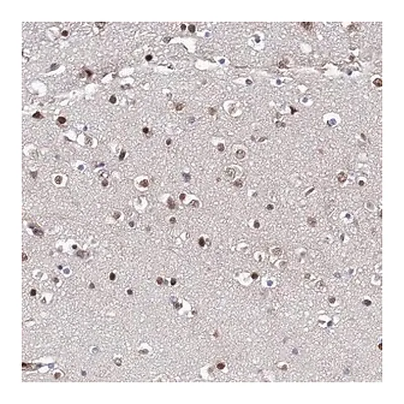Merck Anti-ZNF655 antibody produced in rabbit