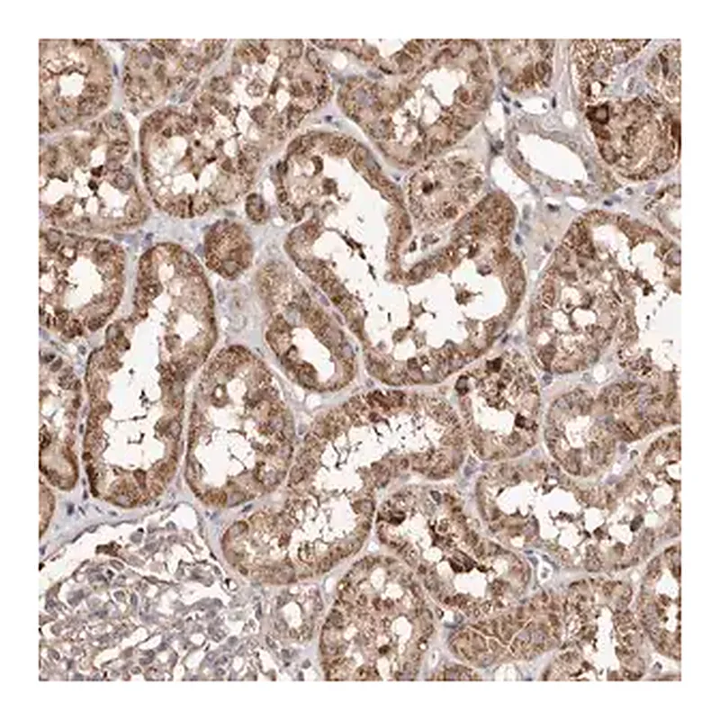 Merck Anti-MACC1 antibody produced in rabbit