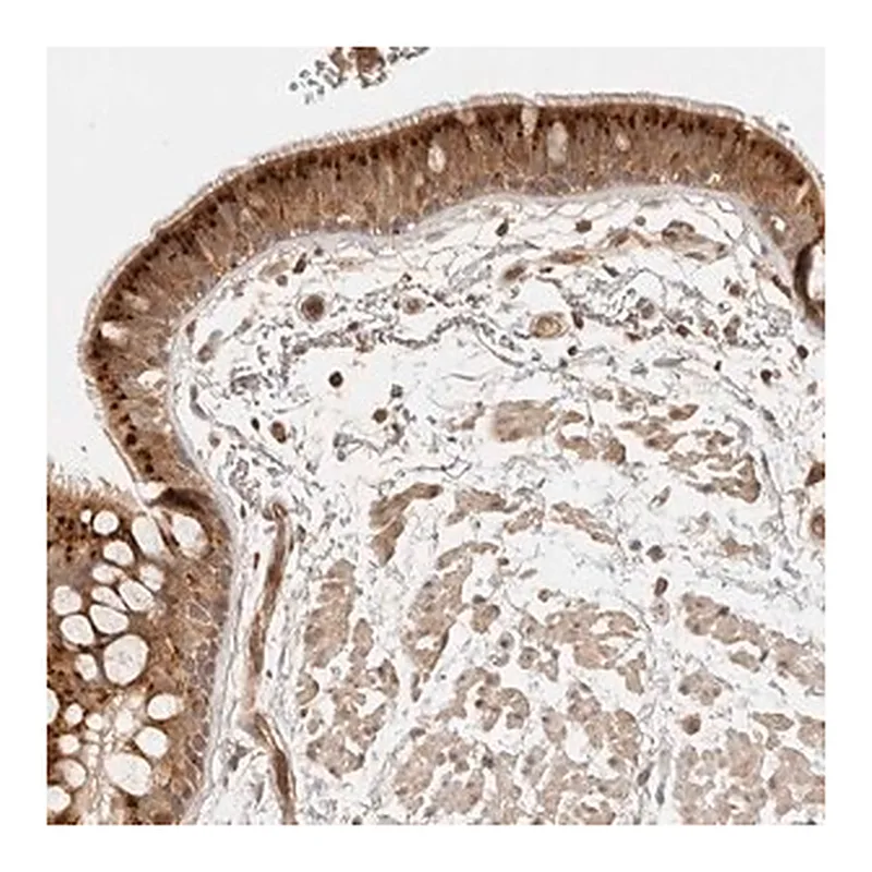 Merck Anti-ANKRD61 antibody produced in rabbit