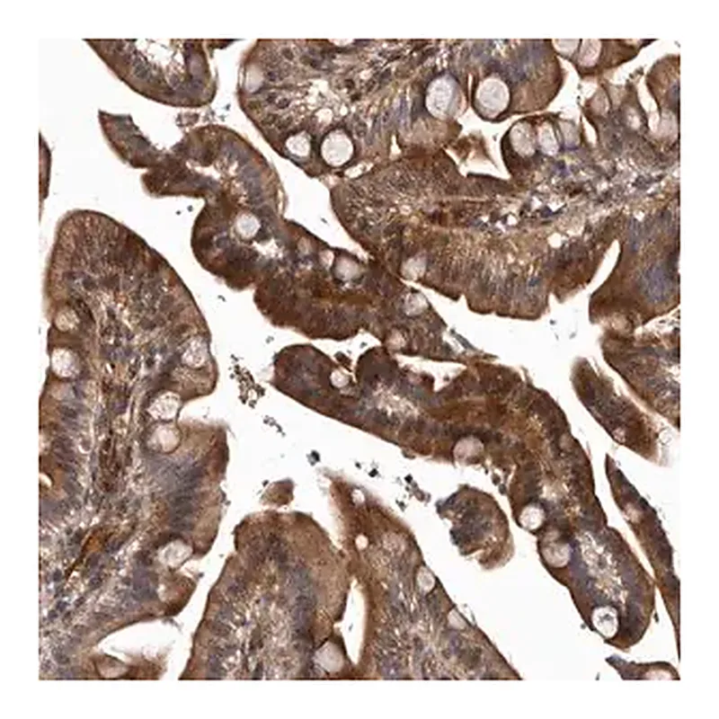 Merck Anti-PRKD3 antibody produced in rabbit