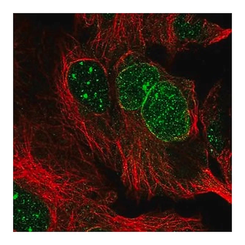 Merck Anti-RANBP17 antibody produced in rabbit