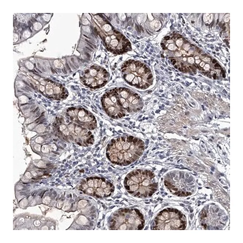Merck Anti-USP45 antibody produced in rabbit