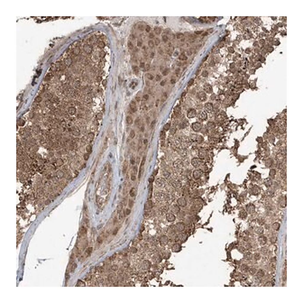 Merck Anti-PAXBP1 antibody produced in rabbit