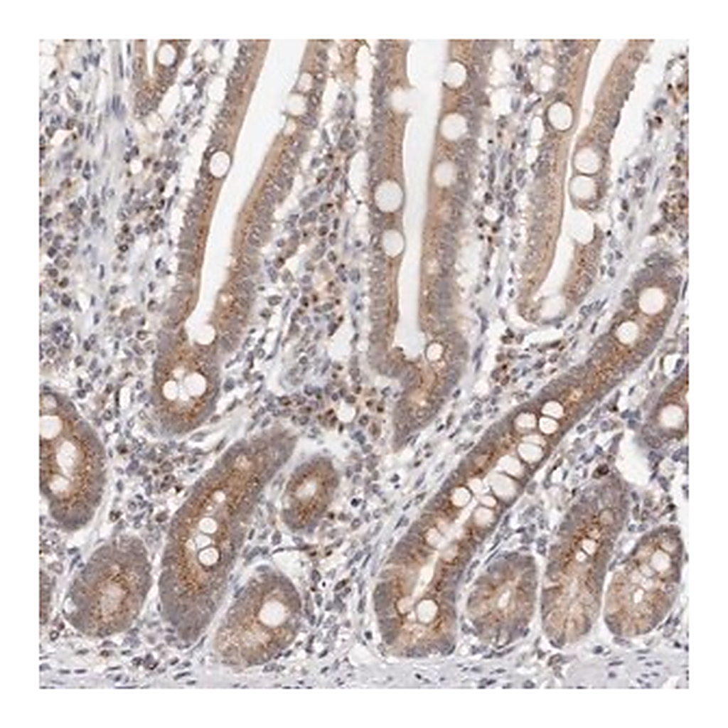 Merck Anti-VIPAS39 antibody produced in rabbit