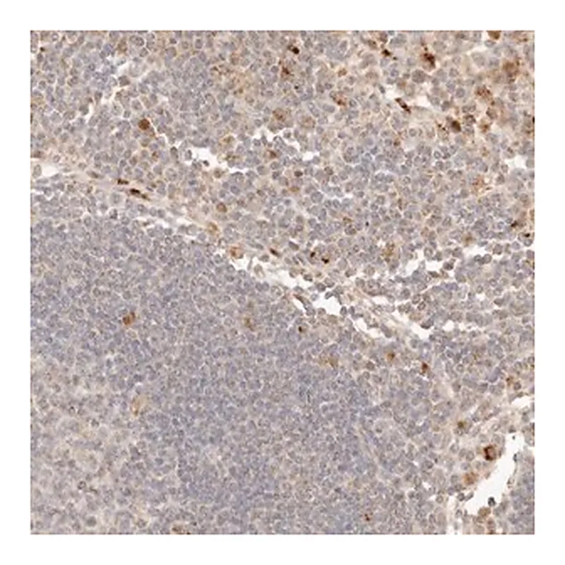 Merck Anti-PTPN22 antibody produced in rabbit