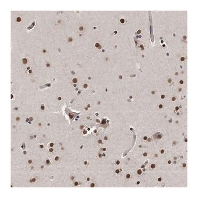 Merck Anti-TP53INP1 antibody produced in rabbit
