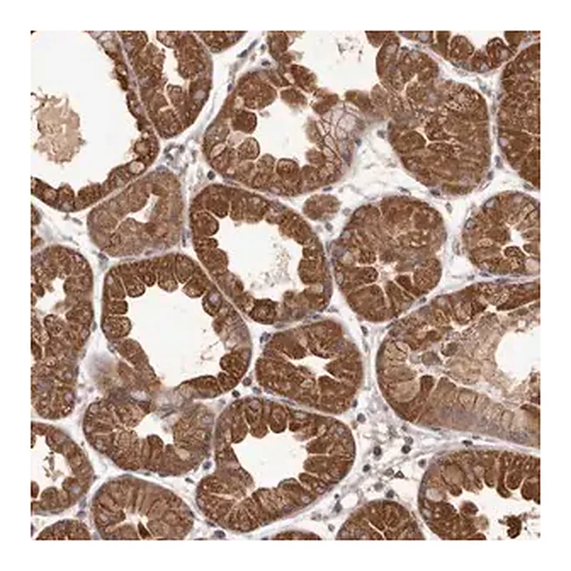 Merck Anti-MGAT5 antibody produced in rabbit