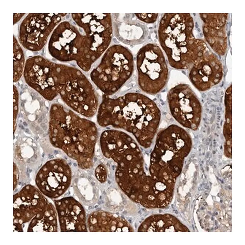 Merck Anti-CAPN15 antibody produced in rabbit