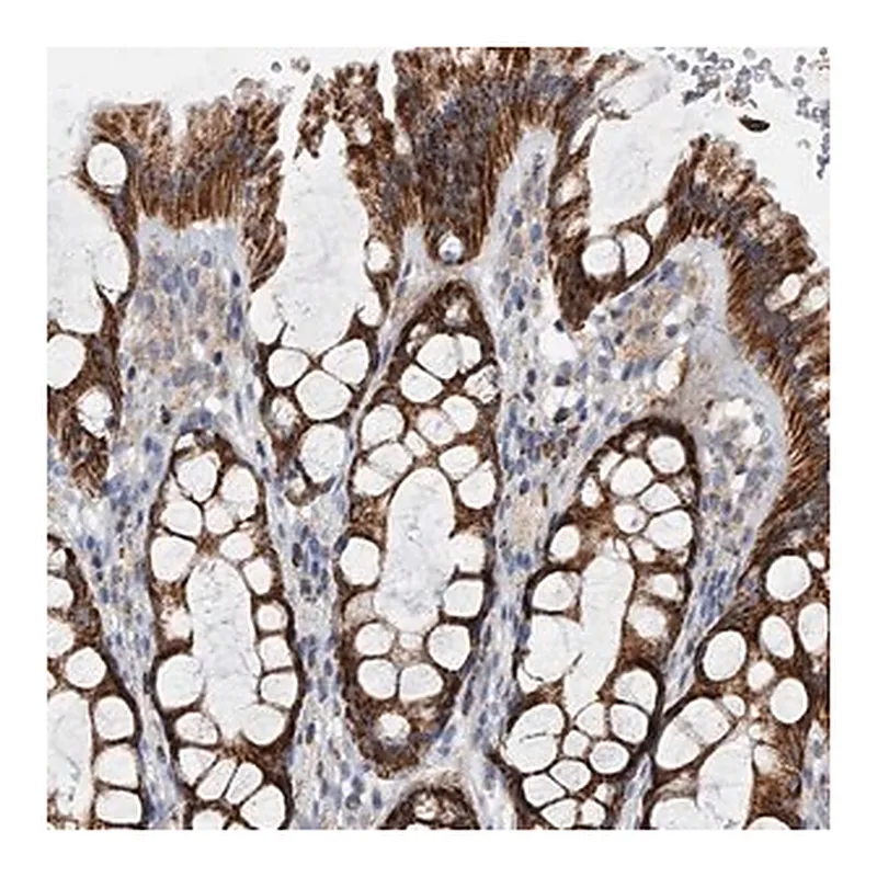 Merck Anti-PDSS2 antibody produced in rabbit