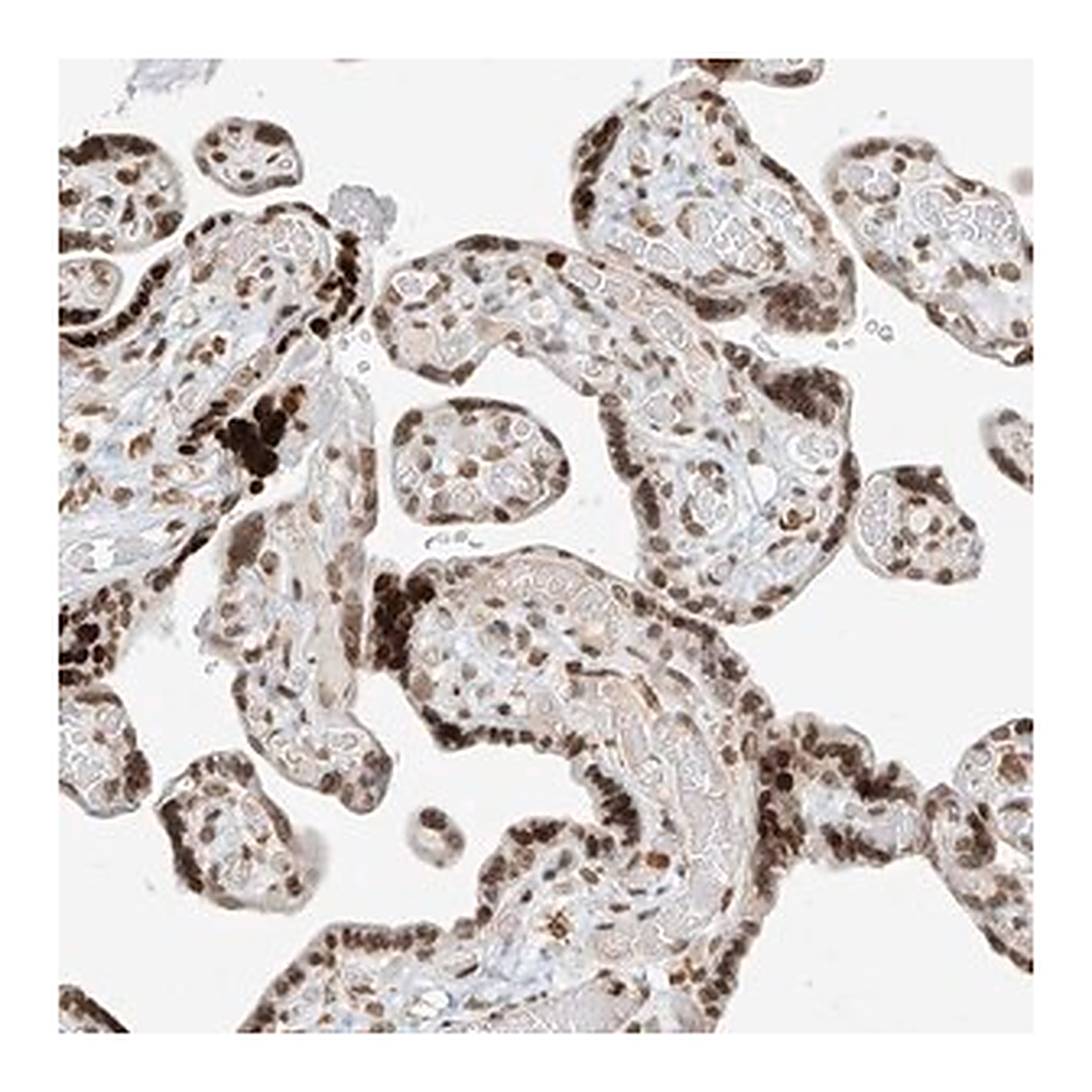 Merck Anti-C17orf58 antibody produced in rabbit