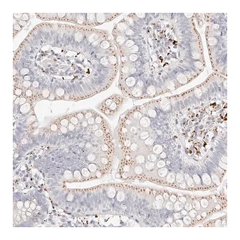 Merck Anti-STKLD1 antibody produced in rabbit