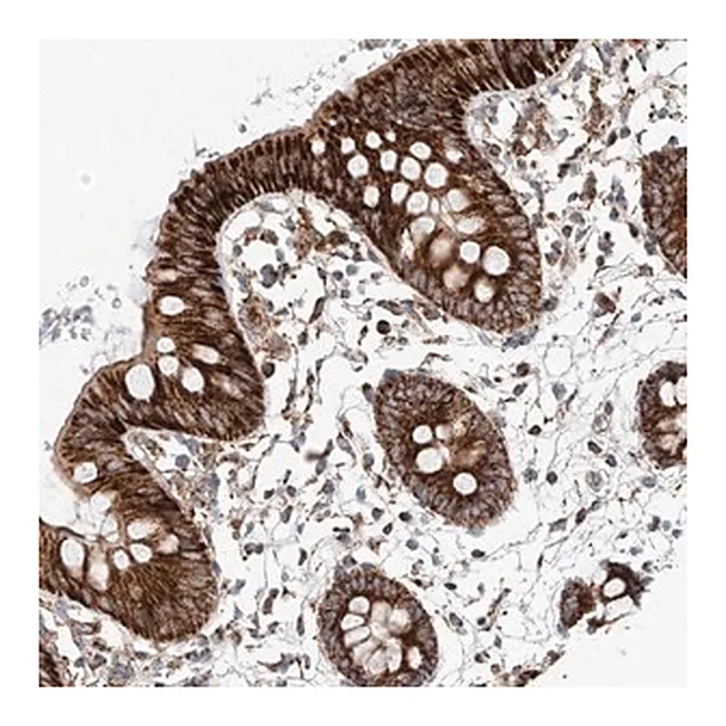 Merck Anti-RUSC1 antibody produced in rabbit