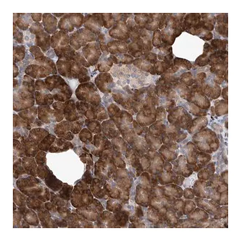 Merck Anti-IBTK antibody produced in rabbit