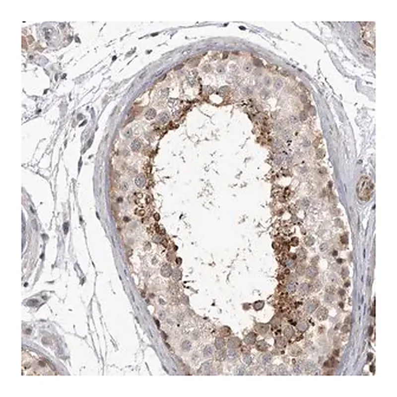 Merck Anti-SSX2IP antibody produced in rabbit