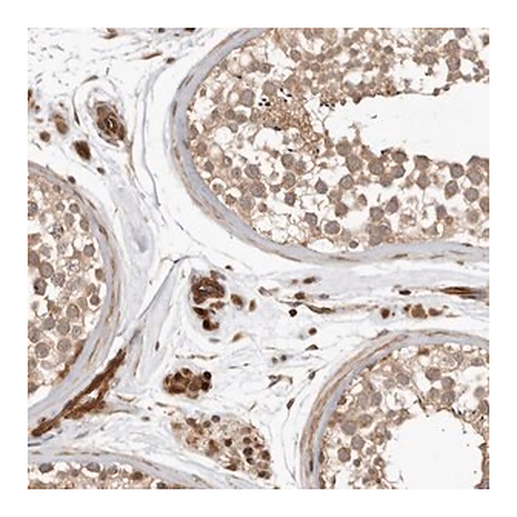 Merck Anti-GPATCH2 antibody produced in rabbit | 캐시바이
