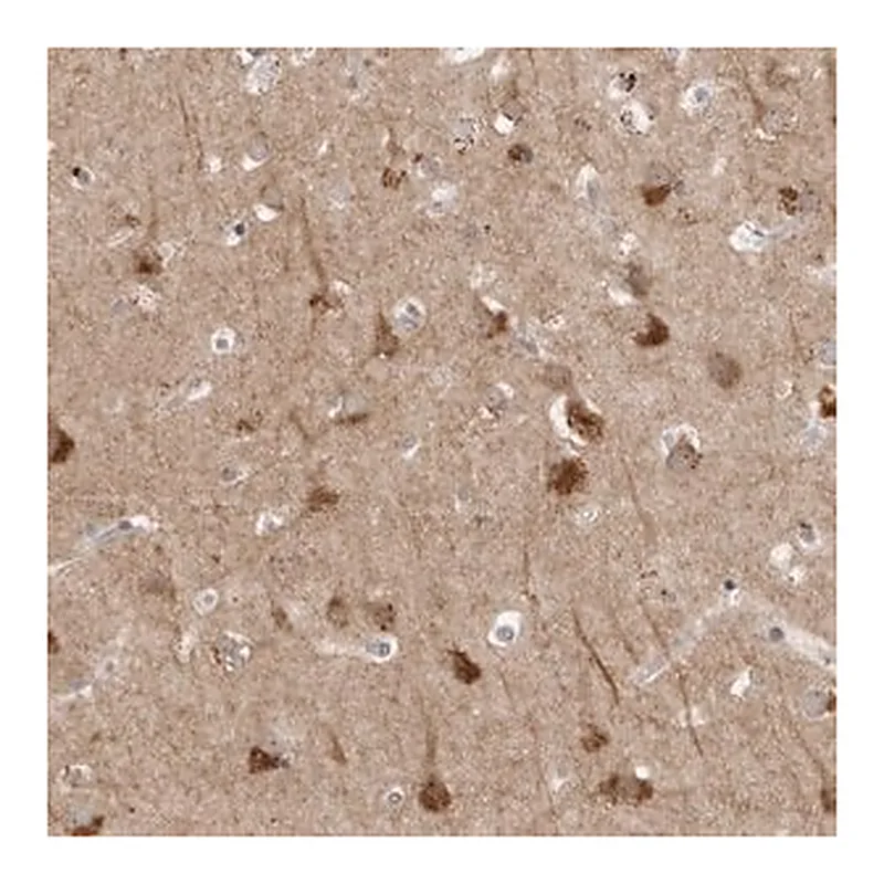 Merck Anti-TNFRSF11A antibody produced in rabbit
