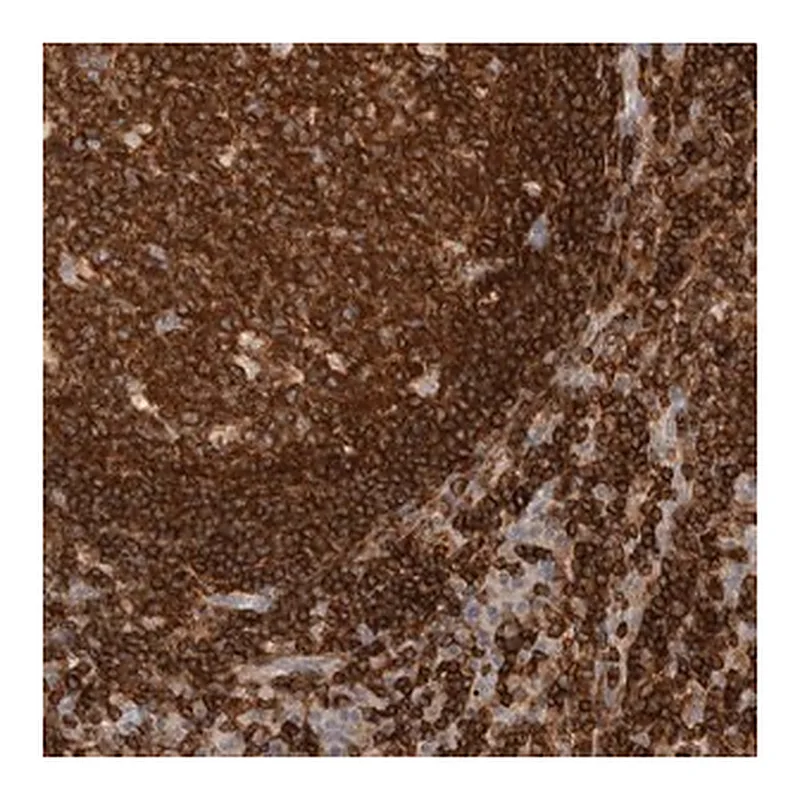 Merck Anti-RUNDC1 antibody produced in rabbit