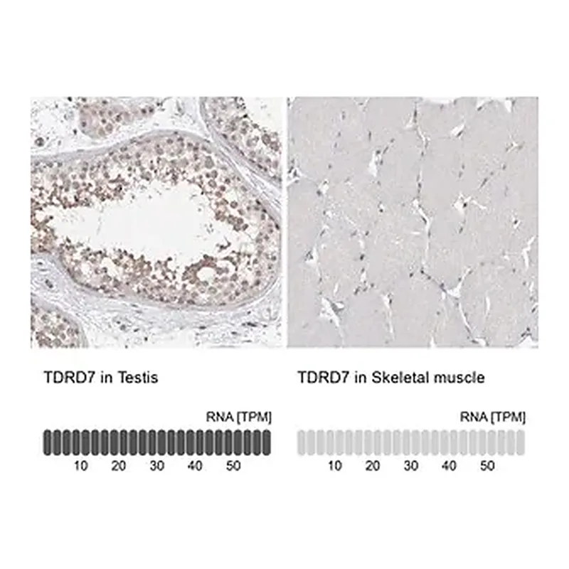 Merck Anti-TDRD7 antibody produced in rabbit