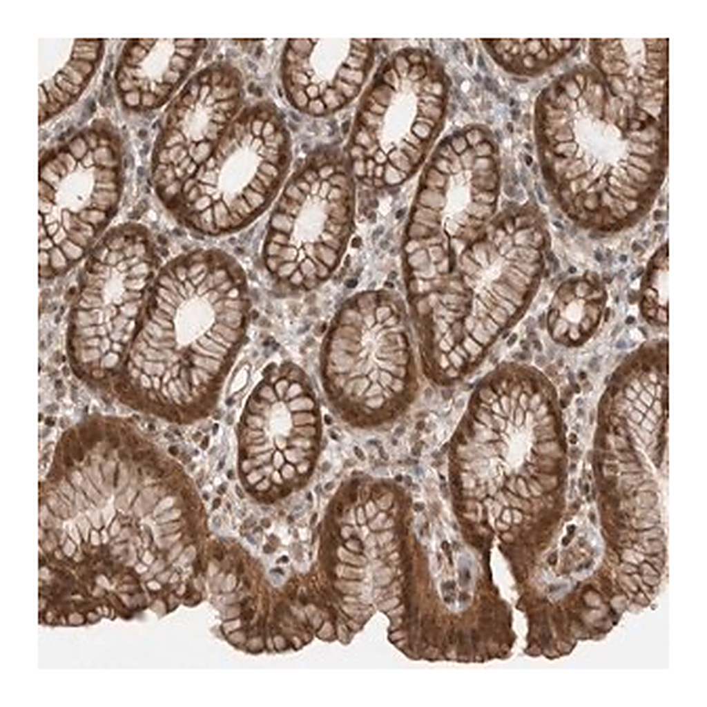 Merck Anti-PEAK1 antibody produced in rabbit