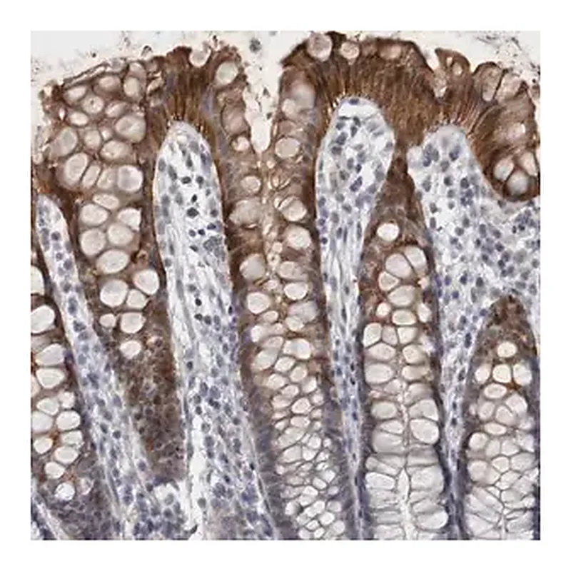 Merck Anti-IFI44 antibody produced in rabbit